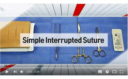 [서울성모병원]외과 시술 동영상 자료